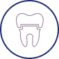 Dental Implants in San Jose California