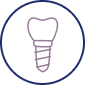 Dental Implants in San Jose California